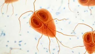 Giardiasis