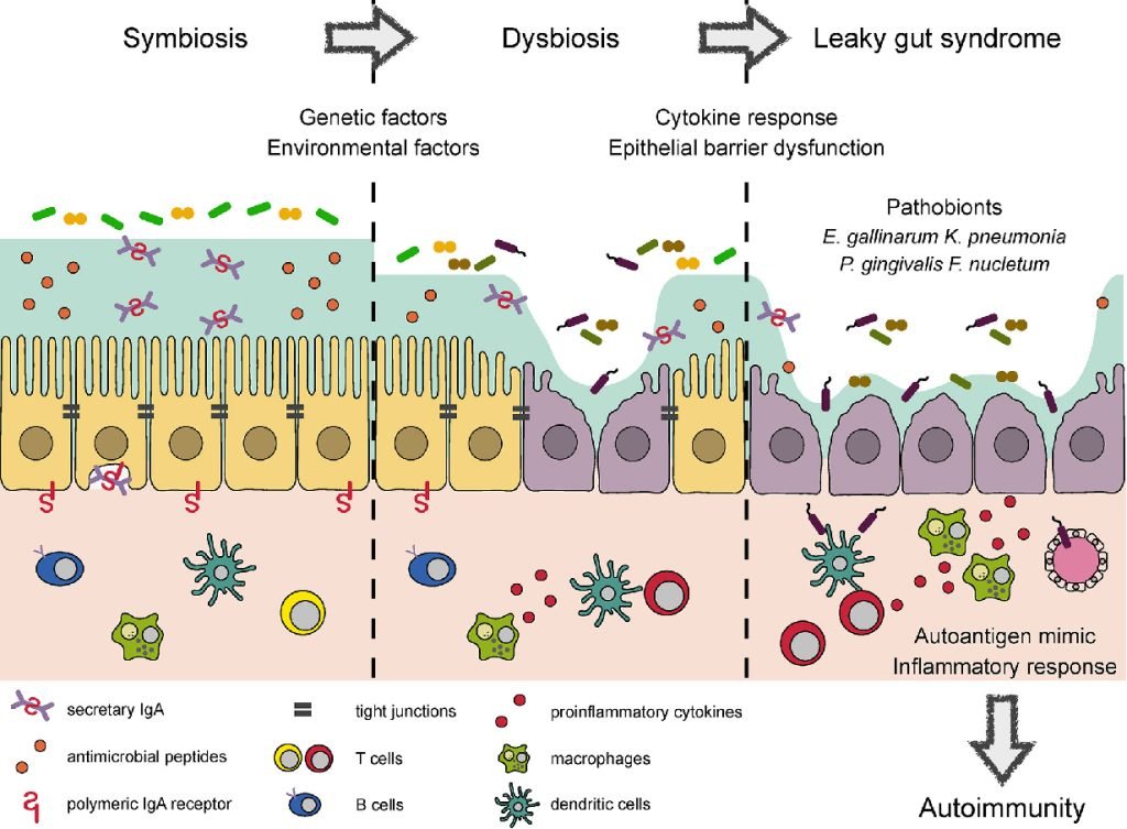 intestino permeable