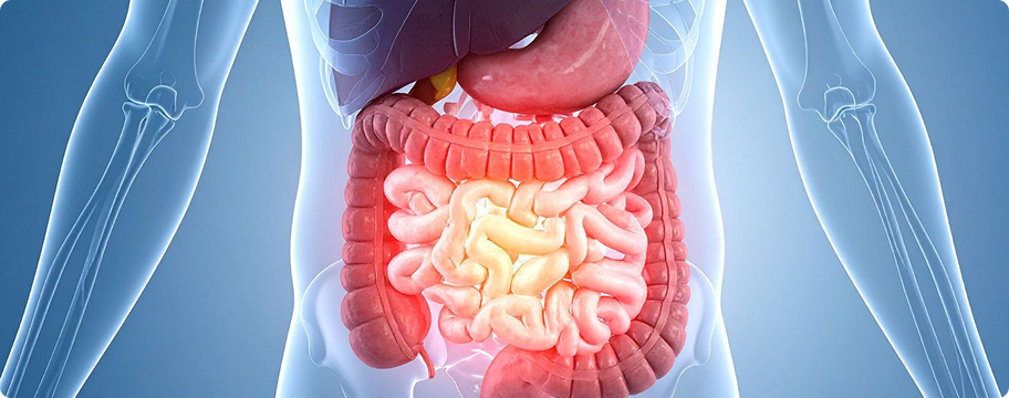 Síndrome de intestino irritable postinfeccioso
